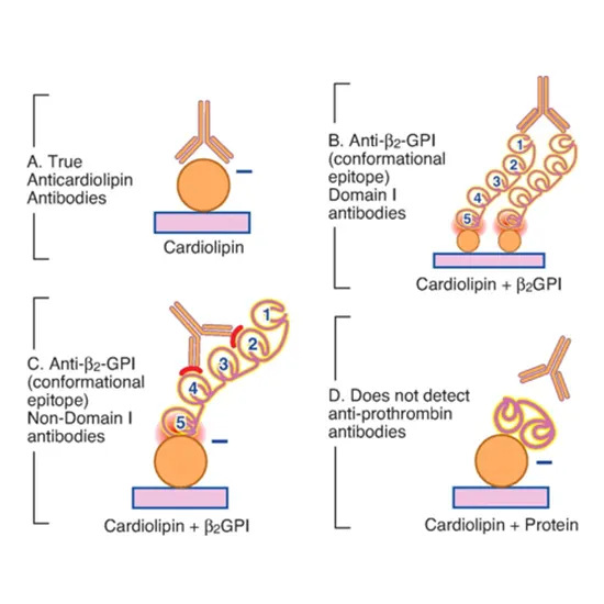 Cardiolipin Antibody IgG and IgM